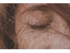 Rozjaśnianie piegów domowymi sposobami