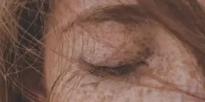 Rozjaśnianie piegów domowymi sposobami