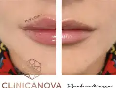 Gdzie skorzystać z medycyny estetycznej w Gdańsku?