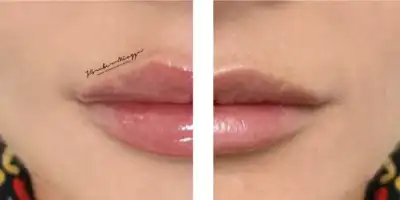 Gdzie skorzystać z medycyny estetycznej w Gdańsku?