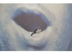 Domowe sposoby na afty