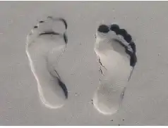 Pękające pięty - wstydliwy problem.