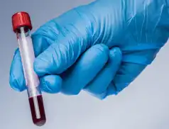 Jak nie przegapić pierwszych objawów zespołu mielodysplastycznego?