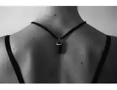 Pieprzyki - kiedy warto wybrać sie do dermatologa?