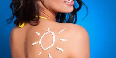Jak ukoić ból po oparzeniu słonecznym podczas wakacji